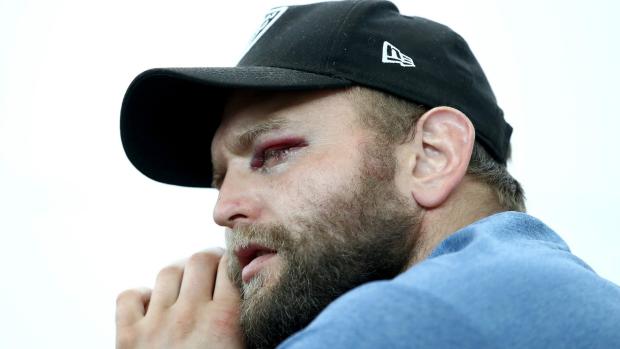 Joe Moody eye injury England