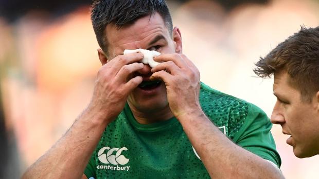 Scotland v Ireland - Guinness Six Nations