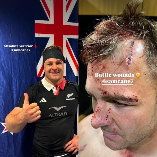 More injury woes for All Blacks