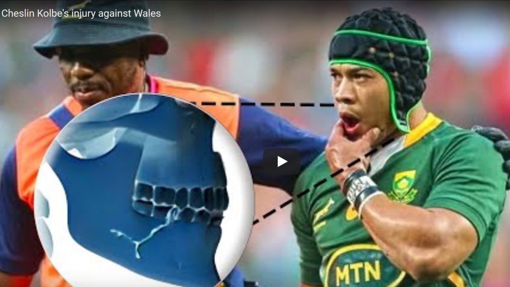 VIDEO: How Cheslin Kolbe fractured his jaw